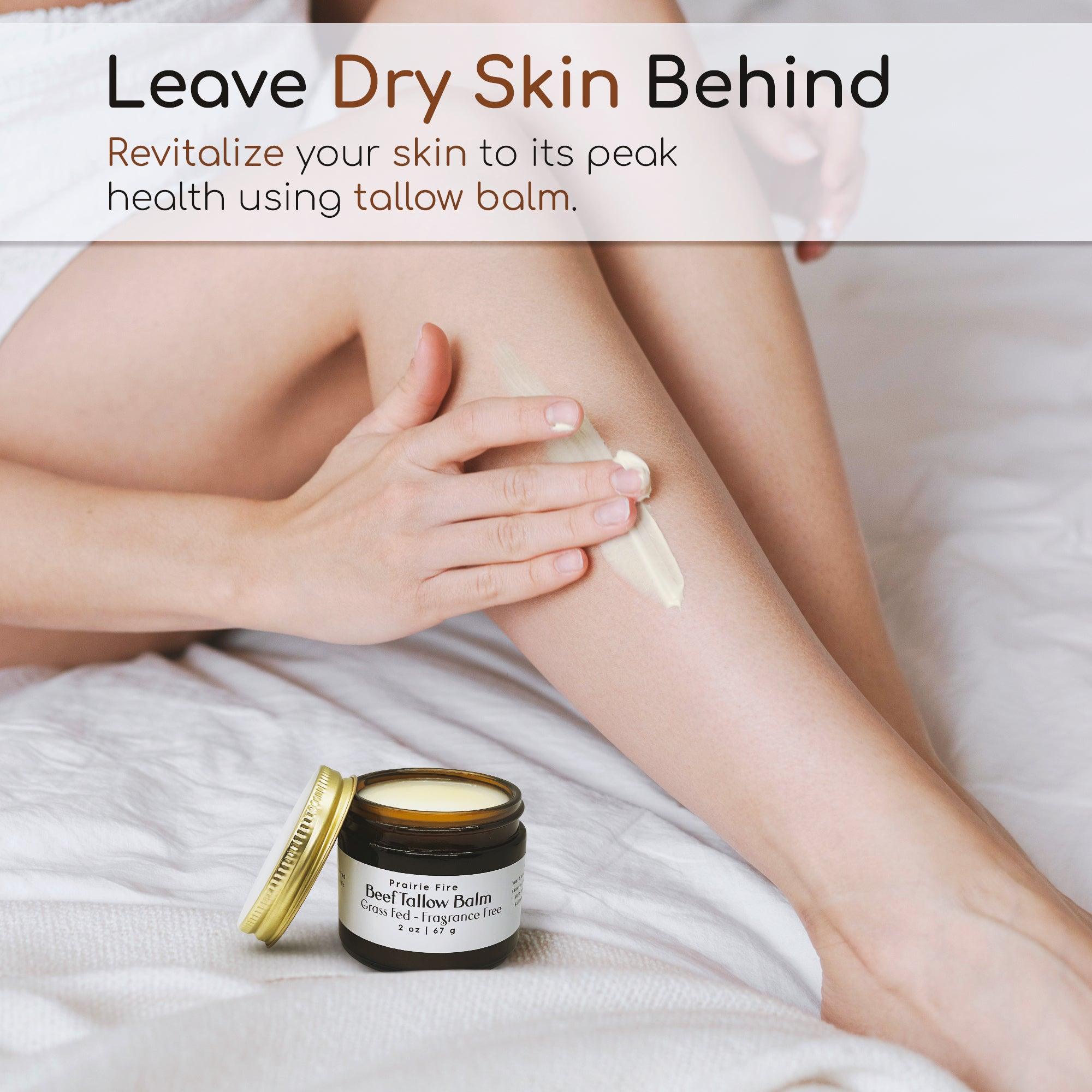 Grass Fed Beef Tallow Balm - 8 oz - Grown and Made in USA - Organic Grass Fed and Finished Tallow - Moisturizing Skin Care